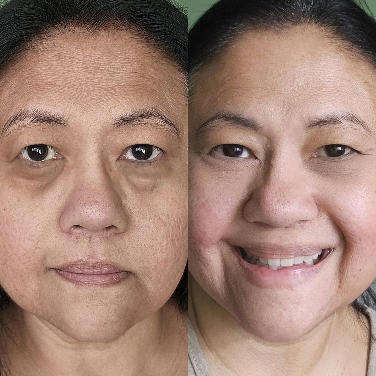 Side-by-side before and after photo