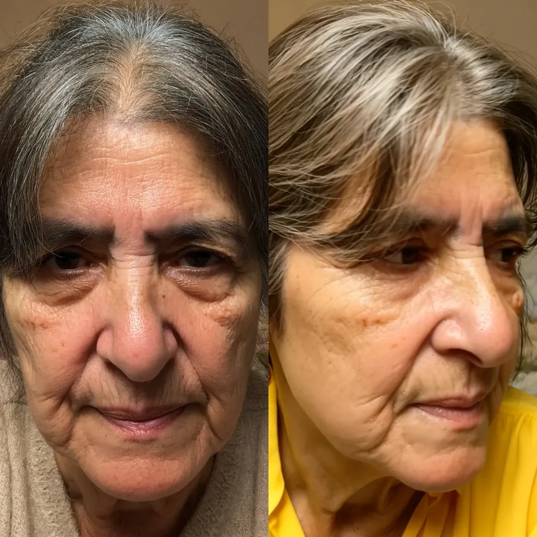 Side-by-side before and after photo