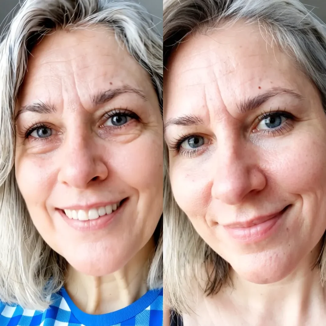 Side-by-side before and after photo