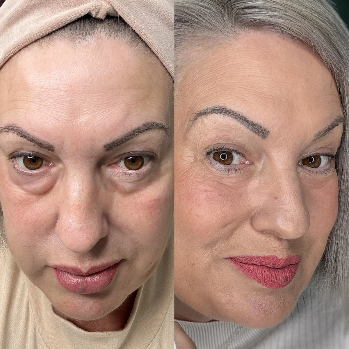 Side-by-side before and after photo