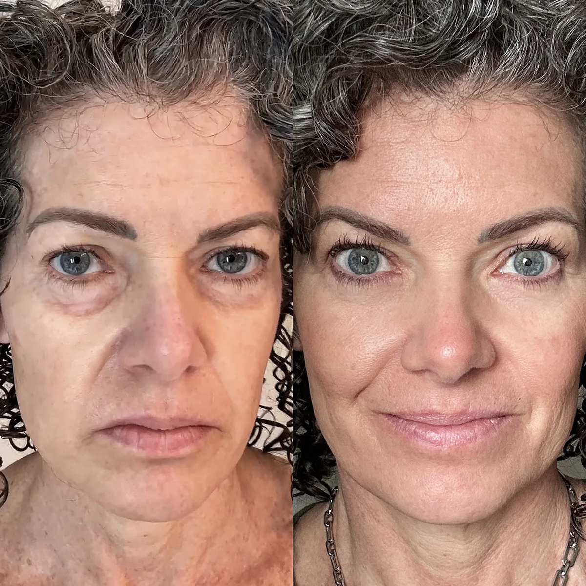 Side-by-side before and after photo